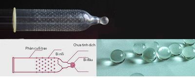 Bao Cao Su Có Viên Bi Lớn Ở Đầu Cho Chị Em Tột Độ Khoái - ảnh 3